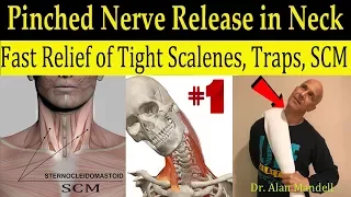 Wicked Neck Stretch for Fast Relief of Tight SCM, Trap, Scalene, & Pinched Nerve - Dr Mandell, DC