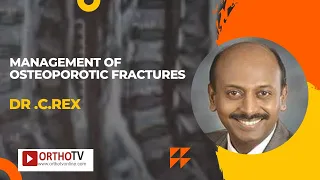 Management of Osteoporotic Fractures - Dr .C.Rex