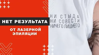 Почему нет результата от лазерной эпиляции?! Противопоказания для процедуры удаления волос!