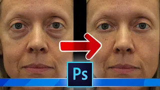 How to remove bags under the eyes in photoshop