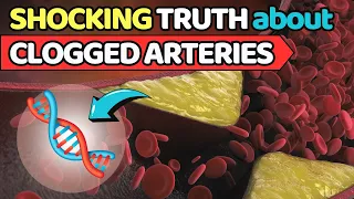 10 SHOCKING TRUTHS About Clogged Arteries and Heart Disease | Vitality Solutions