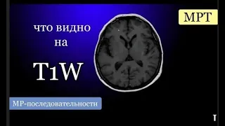 Базовые лекции по МРТ / МР-последовательности: T1W