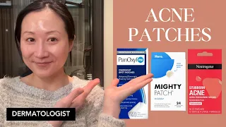 Dermatologist favorite acne patches | Dr. Jenny Liu