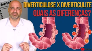 DIVERTICULITE e DIVERTICULOSE: diferenças, sintomas, causa e tratamento