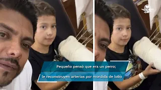 "No hagan lo que yo hice": dan de alta a Alexis, niño mordido por un lobo en zoológico