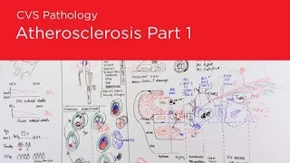 CVS Pathology: Atherosclerosis (Part 1)