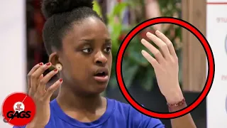 Hand Transplant Goes Wrong... | Just For Laughs Gags