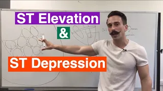 ST Elevation and ST Depression EXPLAINED