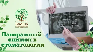✅ Панорамный снимок в стоматологии