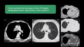 CT Chest   Anatomy & Interpretation    Dr Mamdouh Mahfouz