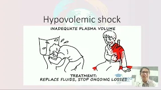 Hypovolemic Shock - Introduction, Pathology, Clinical features and Treatment
