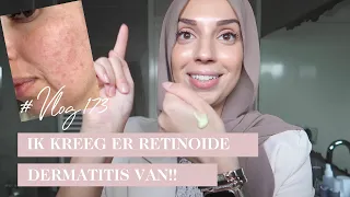 Een flinke rotdag & Hoe verminder je zichtbare poriën?| #Vlog 173 . | Delia Skin Master