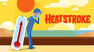 What are early signs of heat stroke? How to treat heat stroke? How to avoid heatstroke?