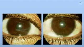 Ocular Manifestations of Systemic Disease