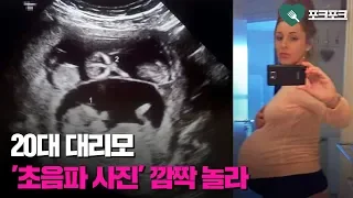 한 부부의 아이 '대리 임신'한 20대. 초음파 사진 보자 놀란 까닭
