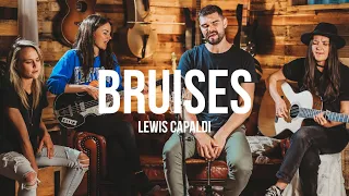 BRUISES - Lewis Capaldi (ACOUSTIC COVER by Germein & Isaac Humphries)