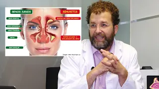 Rinosinusitis crónica con poliposis nasal: síntomas y diagnóstico