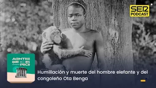 Acontece que no es poco | Humillación y muerte del hombre elefante y del congoleño Ota Benga