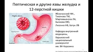 Пептическая и другие язвы желудка и 12 перстной кишки