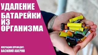 Удаление батарейки из организма/Операция