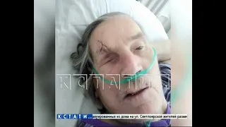 «Старушка напала на автомобиль, ударила его головой и скончалась» - парадоксальные выводы следствия