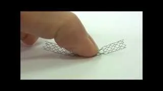 Nitinol stent - elastic memory