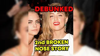 Amber's OTHER "Broken Nose" Story