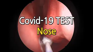 Nose COVID-19 TEST