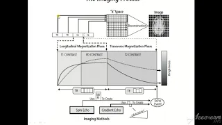 MRI Physics  Part 14 T1 ,T2 and PD اساسيات فيزياء  الرنين المغناظيسي بالعربي