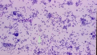 Cytology microscopy