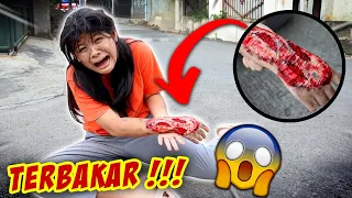 TANGAN CHIARA TERBAKAR !! SAKIT PERIH AMPE NANGIS 😱GARA-GARA...