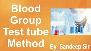 Forward Blood Group Test By Test Tube Method