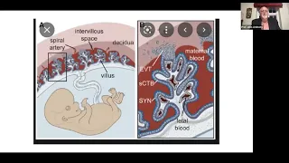 Assessment of fetal wellbeing  Antenatal and Intra partum