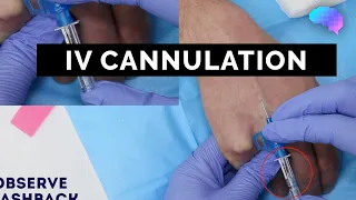 Intravenous (IV) cannulation - OSCE Guide