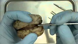 sheep brain dissection