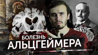 Болезнь Альцгеймера - [История Медицины]