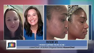 'LaserChat’ - S2 Ep3: Active Acne, Melasma, Leg Veins, and Laxity of the Neck