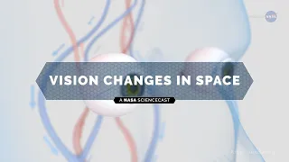 NASA ScienceCasts: Vision Changes in Space