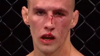 Rory MacDonald  как менялось лицо