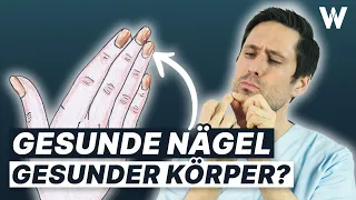 Schlechte Fingernägel: Brüchig, gelb und Rillen! Zeichen für böse Erkrankungen?