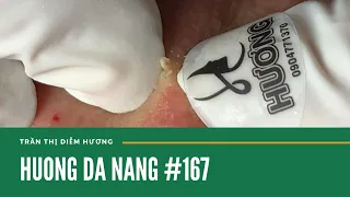 #167 | Huong Da Nang