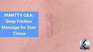 Can you use Deep Friction Massage to Realign Scar Tissue?