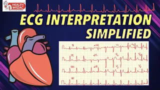 ECG INTERPRETATION SIMPLIFIED | ECG REPORTING SIMPLIFIED | HOW TO READ  ECG | ECG READING SIMPLIFIED