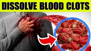 TOP 6 Vitamins To DISSOLVE Your BLOOD CLOTS