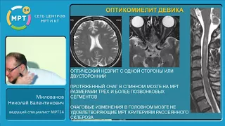 "МРТ в диагностике очаговых изменений спинного мозга"