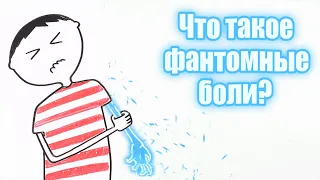 Что такое фантомные боли?