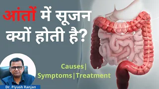 😣Ulcerative Colitis | Causes, Symptoms, Diagnosis and Treatment | By Dr. Piyush Ranjan In Hindi