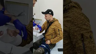 Сломал руку - Где хорошая клиника в Крыму.