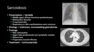 Chest Radiology - Imaging of Interstitial and Diffuse Disease