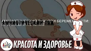 Амниотический тяж